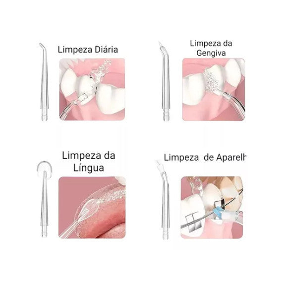 Lava a Jato Bucal